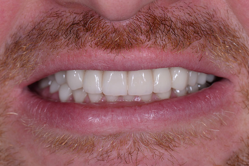 After