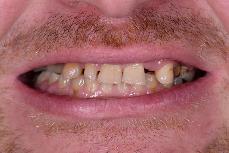 Before