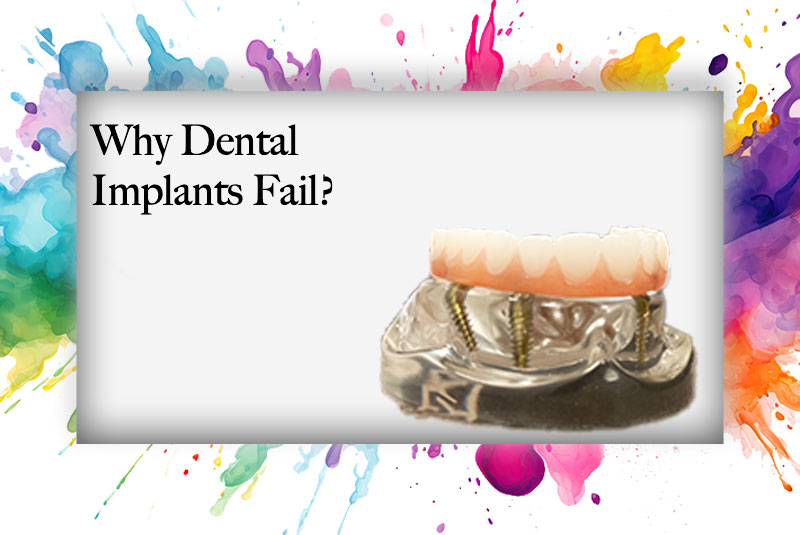 dental implants fail